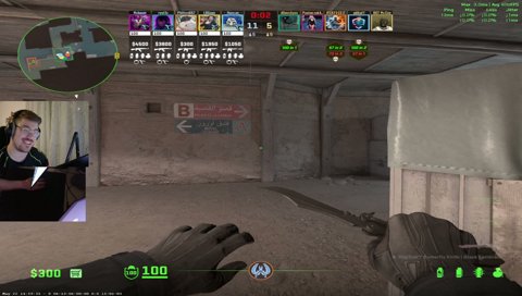arm jitter - Philton_K_